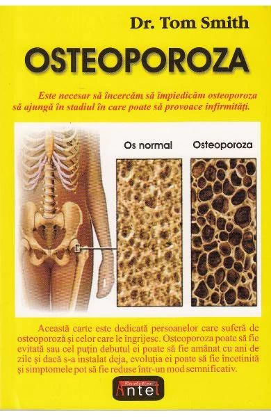 Osteoporoza - carte - tom smith, editura viata si sanatate